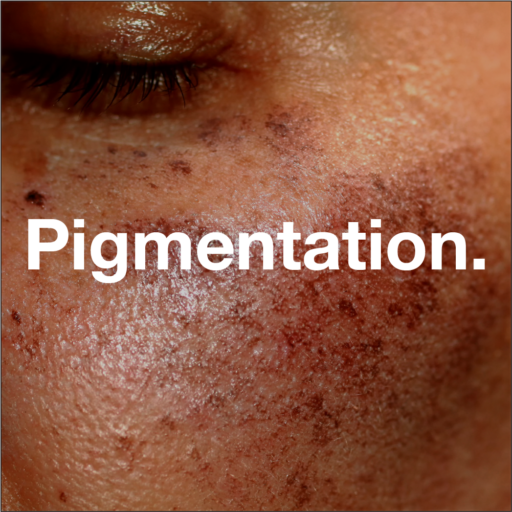 Hyperpigmentation / Uneven Skin Tone