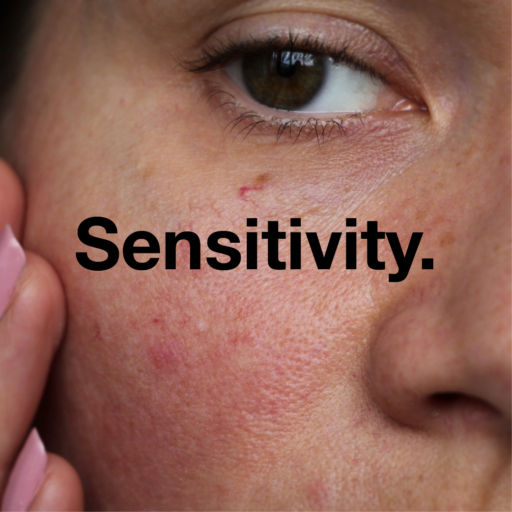 Sensitivity