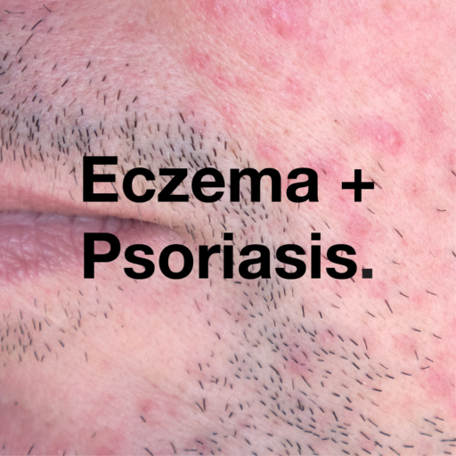 Eczema & Psoriasis Management