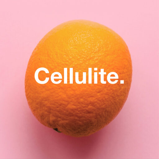 Cellulite